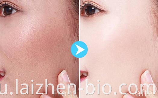 whitening for face